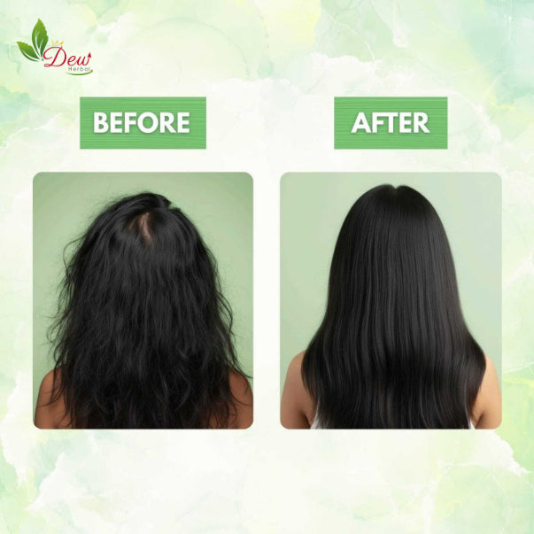 Anti Hairfall Oil